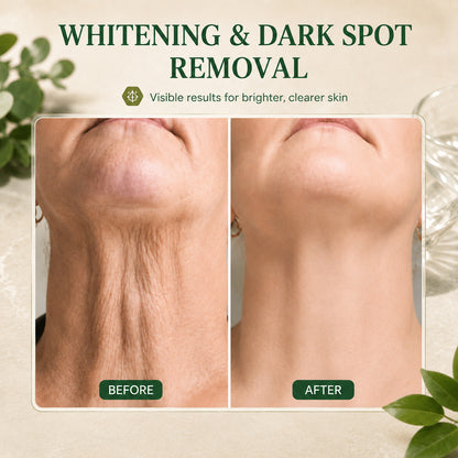 | Last Day Promotion 𝟕𝟎%𝐎𝐅𝐅| - Sparklyra® SkinFirming Rejuvenating Serum