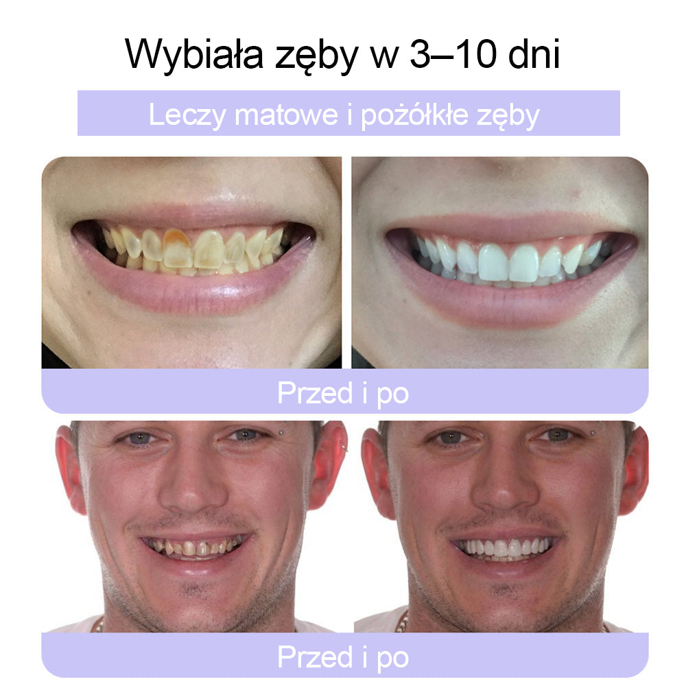 🦷CleraNature® Proszek Mineralny do Odnowy Zębów🔮