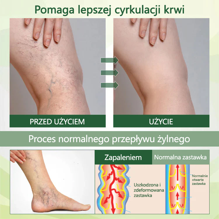 Pożegnaj się z opuchniętymi, bolącymi nogami – CleraNaure® FluidEase Profesjonalny krem na krążenie w nogach przynosi prawdziwą ulgę! ✨🦵