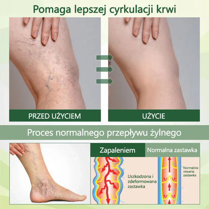 Pożegnaj się z opuchniętymi, bolącymi nogami – CleraNaure® FluidEase Profesjonalny krem na krążenie w nogach przynosi prawdziwą ulgę! ✨🦵
