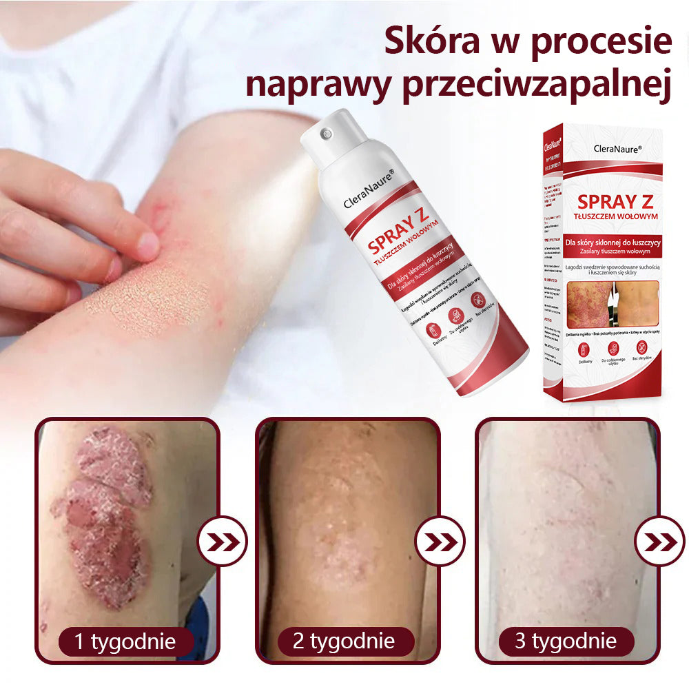 🥇CleraNature® Beef Tallow Spray dla swędzącej, łuszczącej się skóry skłonnej do łuszczycy🥇