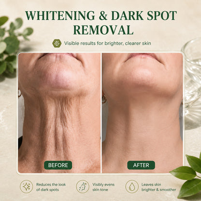 | Last Day Promotion 𝟕𝟎%𝐎𝐅𝐅| - Sparklyra® SkinFirming Rejuvenating Serum