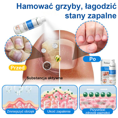 CleraNature® Magnesium Spray – Szybka Ulga dla Swędzącej, Czerwonej i Wrażliwej Skóry (Nawet w Strefach Intymnych)