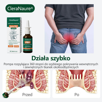 🎁 Oferta ograniczona czasowo | CleraNaure® Szybki Sprays Hemoroidalny PRO