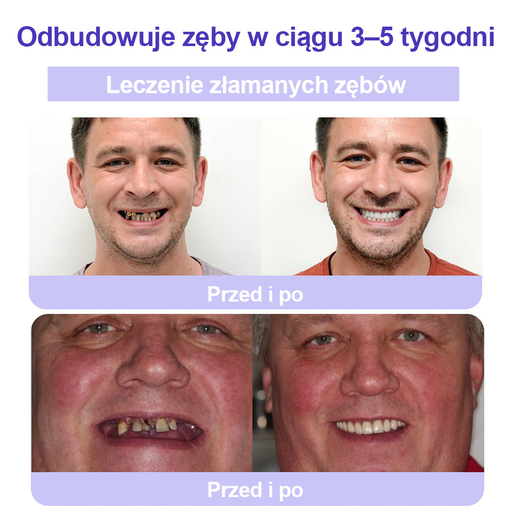 🦷CleraNature® Proszek Mineralny do Odnowy Zębów🔮