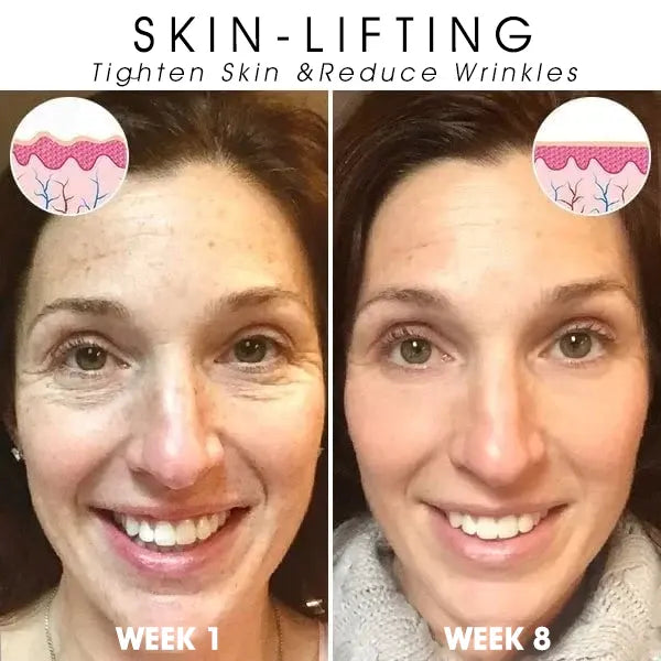 | Last Day Promotion 𝟕𝟎%𝐎𝐅𝐅🌿💝| - 💧Fubsta® SkinFirming Rejuvenating Serum🔥