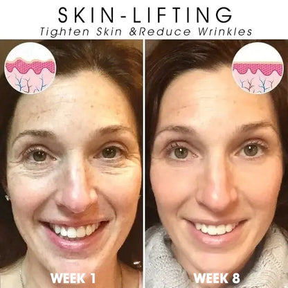 | Last Day Promotion 𝟕𝟎%𝐎𝐅𝐅🌿💝| - 💧Fubsta® SkinFirming Rejuvenating Serum🔥