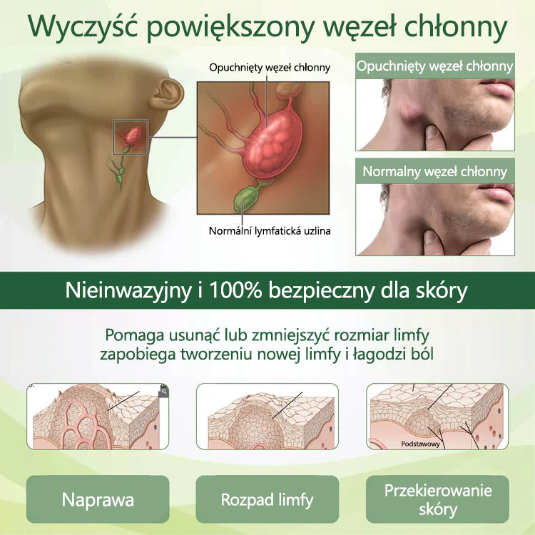Pożegnaj się z opuchniętymi, bolącymi nogami – CleraNaure® FluidEase Profesjonalny krem na krążenie w nogach przynosi prawdziwą ulgę! ✨🦵