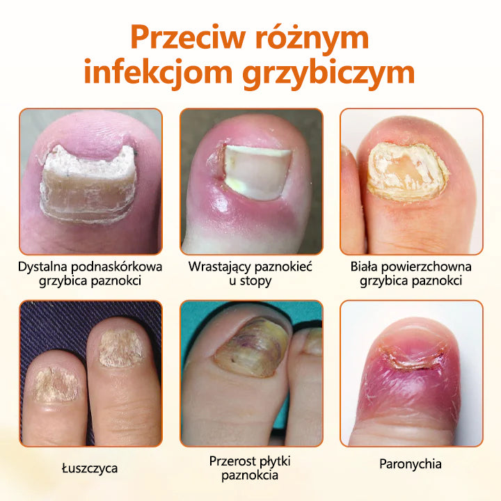 CleraNaure® FungiBee Zaawansowany Spray Naprawczy do Paznokci