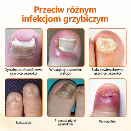 CleraNaure® FungiBee Zaawansowany Spray Naprawczy do Paznokci