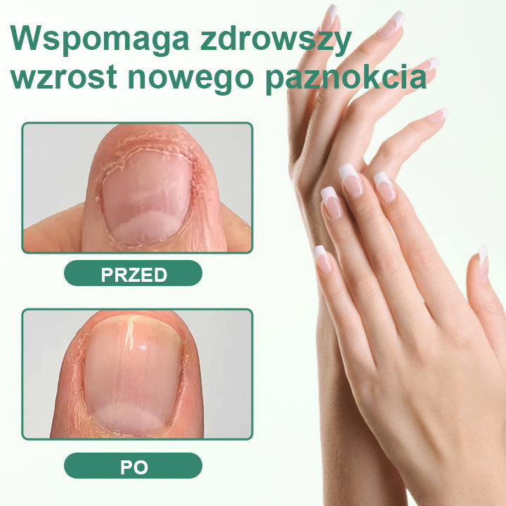 CleraNaure® Penetrujące Serum w Pisaku do Detoksu Paznokci