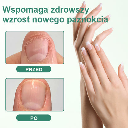 CleraNaure® Penetrujące Serum w Pisaku do Detoksu Paznokci