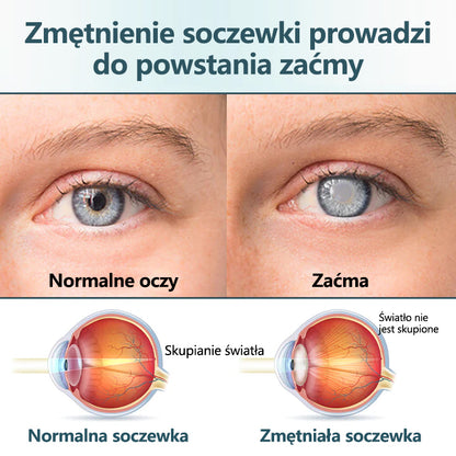 CleraNaure® Optifusion Nano Krople do Oczu Serum-Nanotechnologia przywraca wyraźne widzenie, bez okularów, bez interwencji chirurgicznej