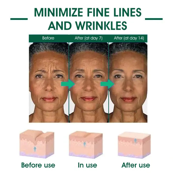 | Last Day Promotion 𝟕𝟎%𝐎𝐅𝐅🌿💝| - 💧Fubsta® SkinFirming Rejuvenating Serum🔥