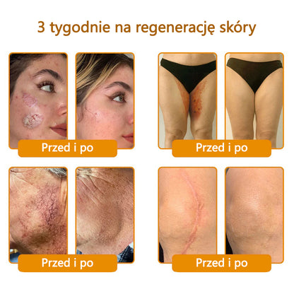 CleraNature® Krem do regeneracji skóry z jadem pszczelim