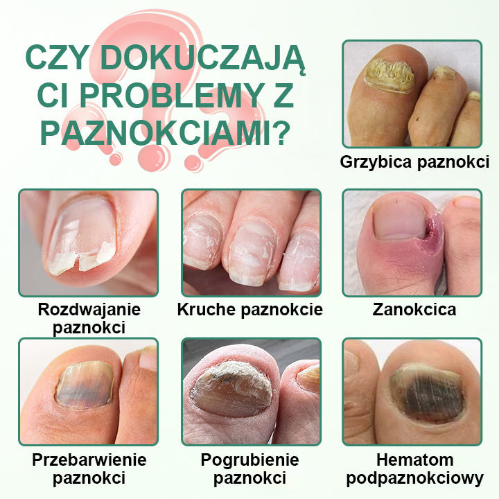 CleraNaure® Penetrujące Serum w Pisaku do Detoksu Paznokci