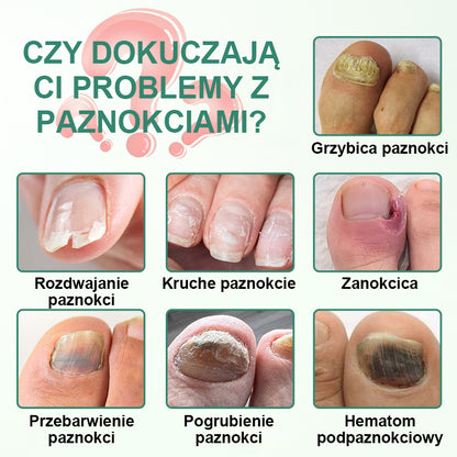CleraNaure® Penetrujące Serum w Pisaku do Detoksu Paznokci