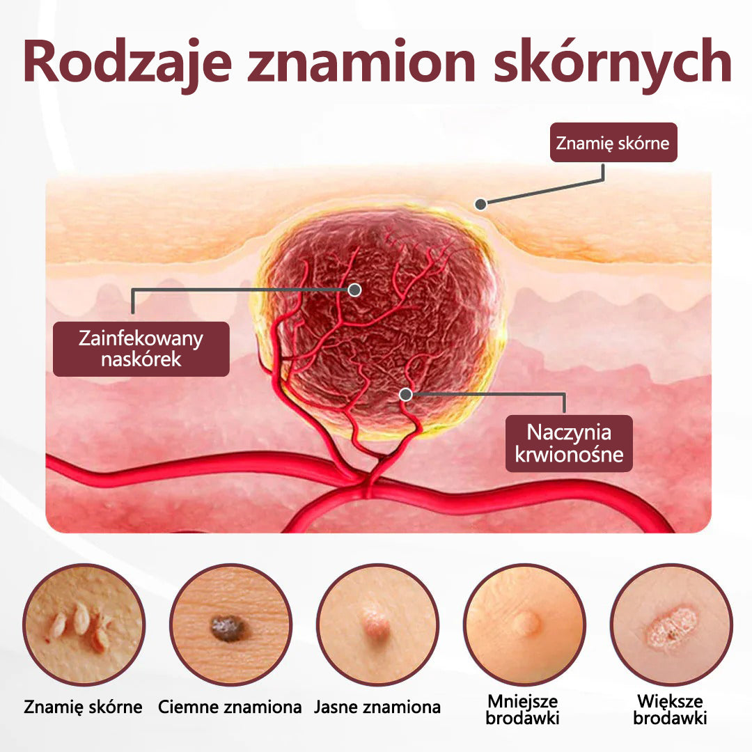 ⭐🏅 Oficjalny sklep CleraNaure® Keraerase Krem Odnowy o Podwójnym Działaniu - Krem z podwójnym działaniem do regeneracji skóry (wygładza wypukłe grudki i rozkłada głębokie nagromadzenie keratyny bez kwasów i podrażnień)