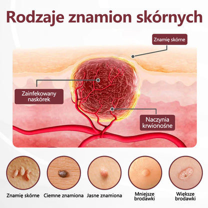 💎 CleraNaure® Keraerase Krem Odnowy o Podwójnym Działaniu - Krem z podwójnym działaniem do regeneracji skóry💎