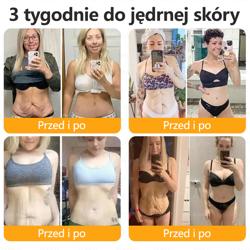 CleraNature® Krem do regeneracji skóry z jadem pszczelim